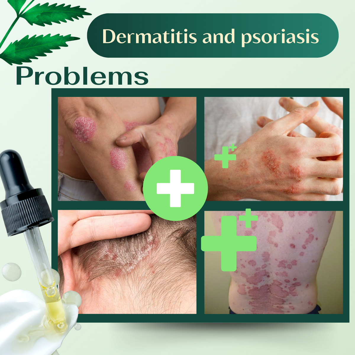 Crema Abera Fordyce - La solución #1 recomendada por dermatólogos para las manchas de Fordyce en los labios