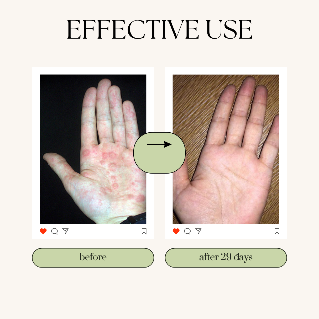 ABERA Alan Silver Nano Serum - Best Seller - US