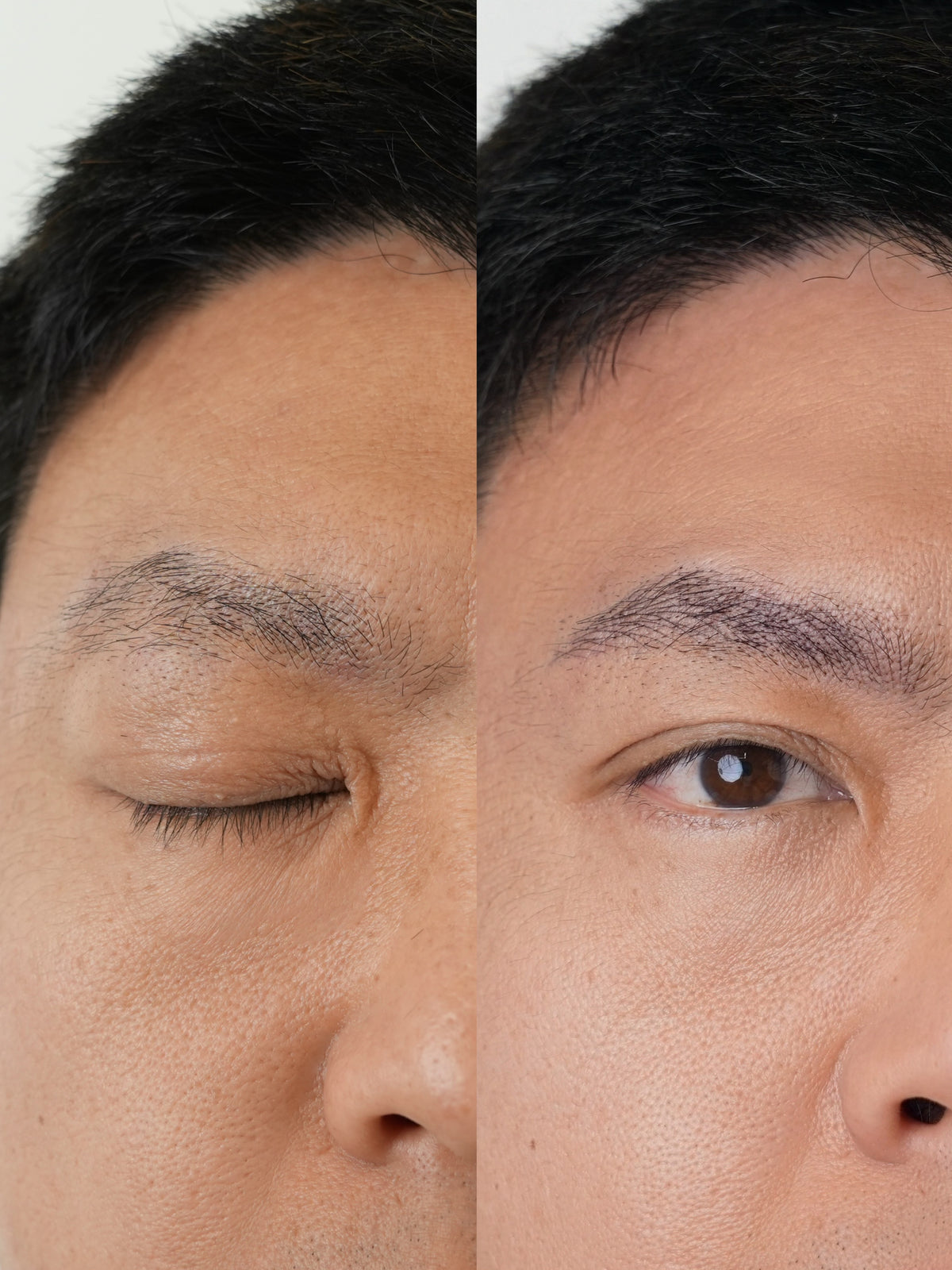 Care for dry-looking skin around the hairline and ears