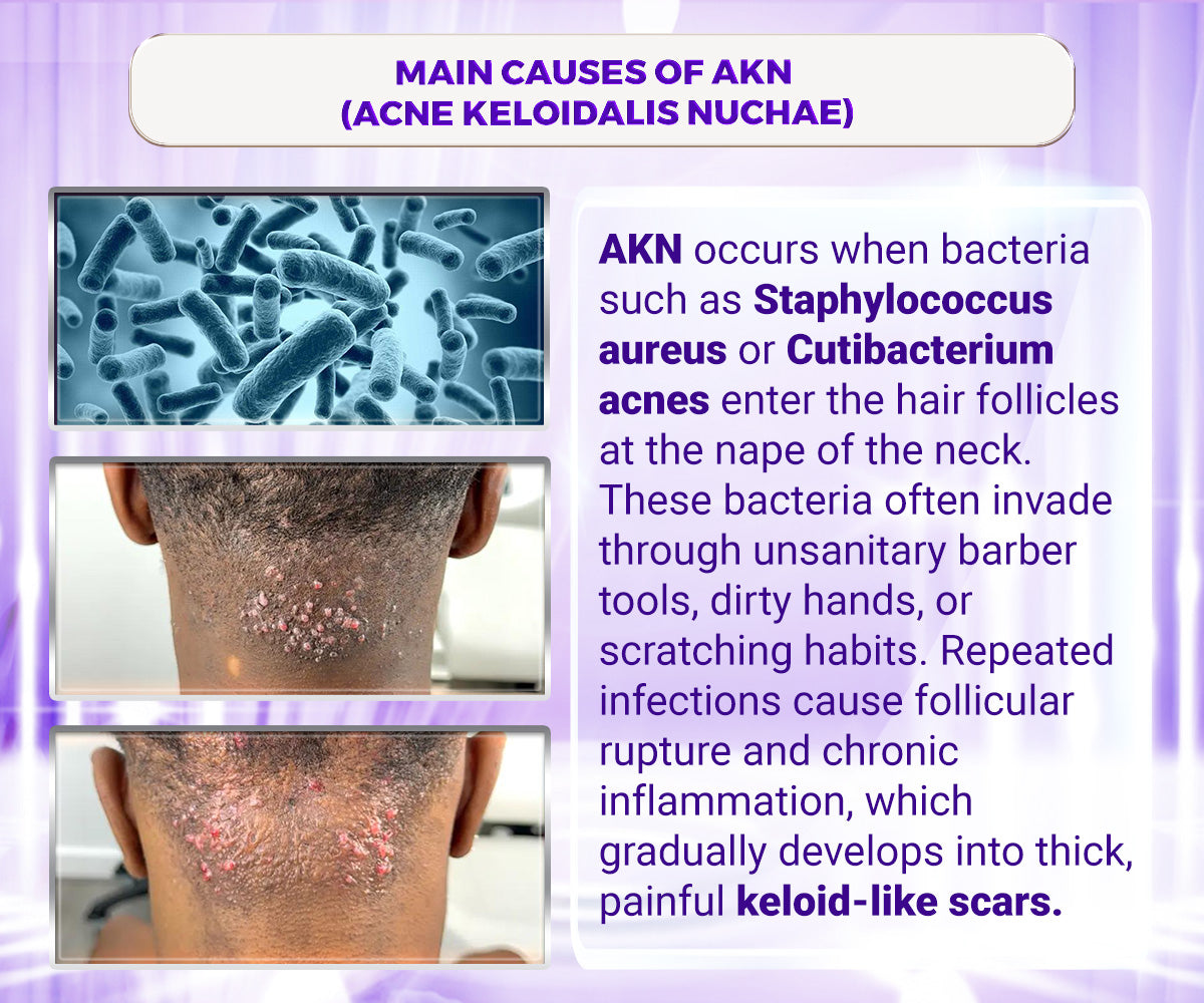 Abera Kelo Scar Cream