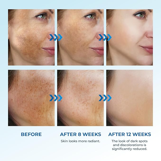 Dark Spot Correcting Duo – Targets Localized Dark Spots for an Even, Radiant Complexion