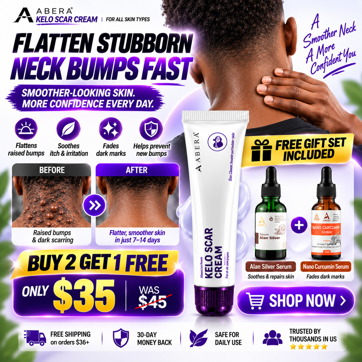 Abera Kelo Scar Cream – Clinical Formula for Raised Scars