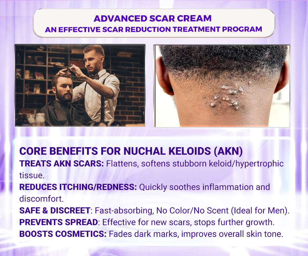 Abera Kelo Scar Cream