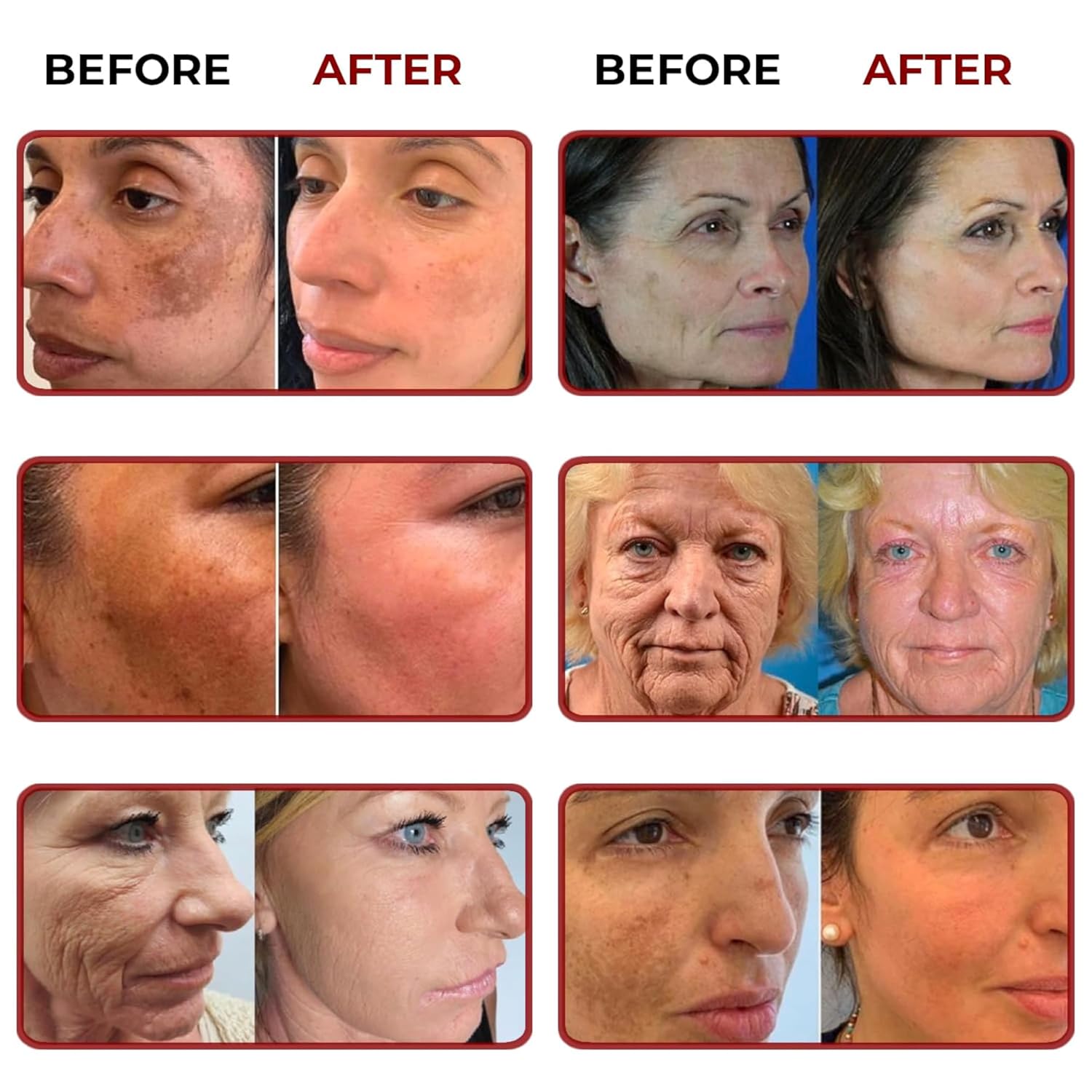 Skin-Renewal Duo – Refines Texture, Smooths Roughness and Brightens Dull Skin