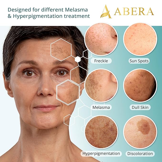 Intensive Melasma Care Duo – Targets Dark Spots, Freckles and Long-Term Discoloration