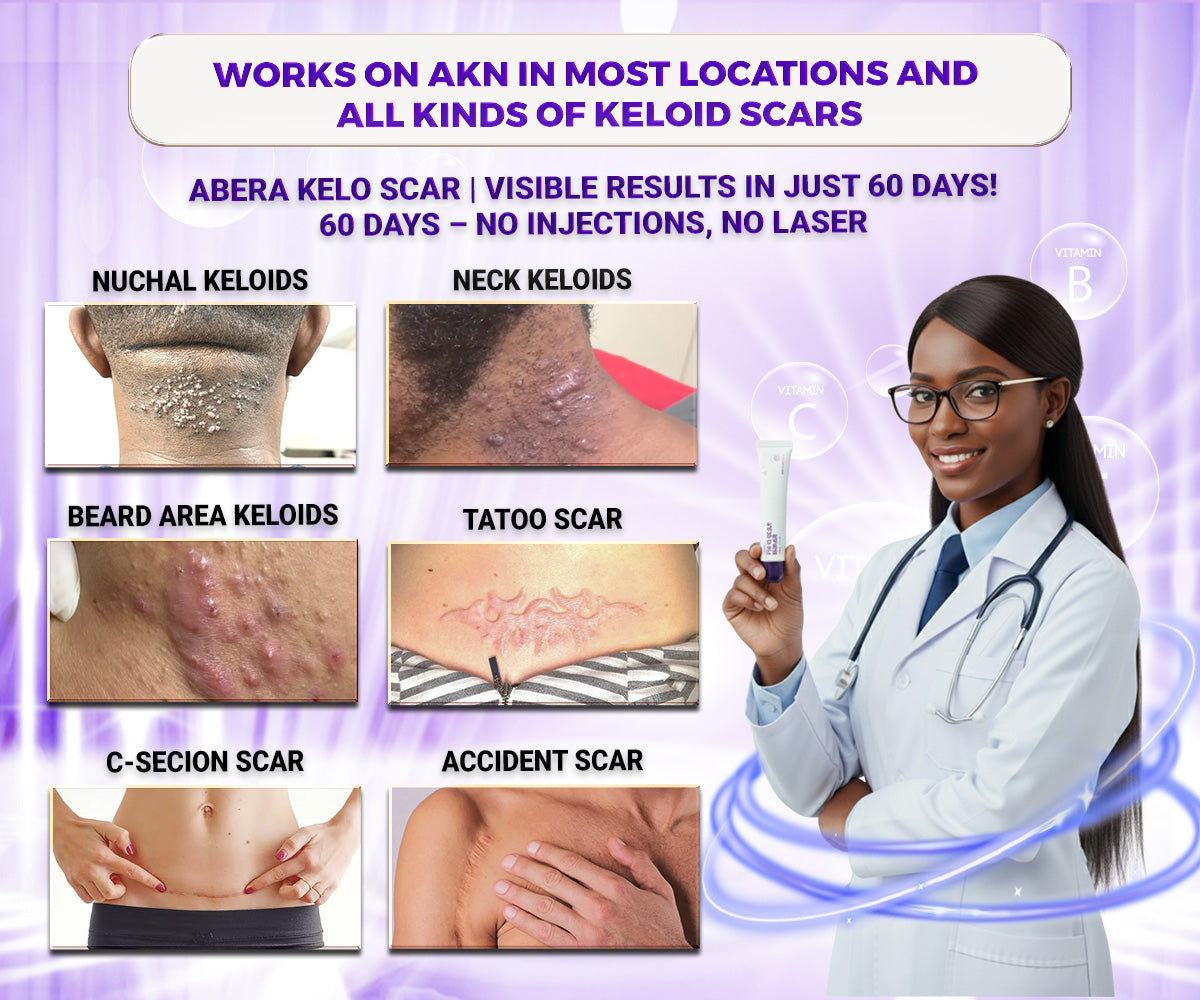 Abera Kelo Scar Cream - Authentic