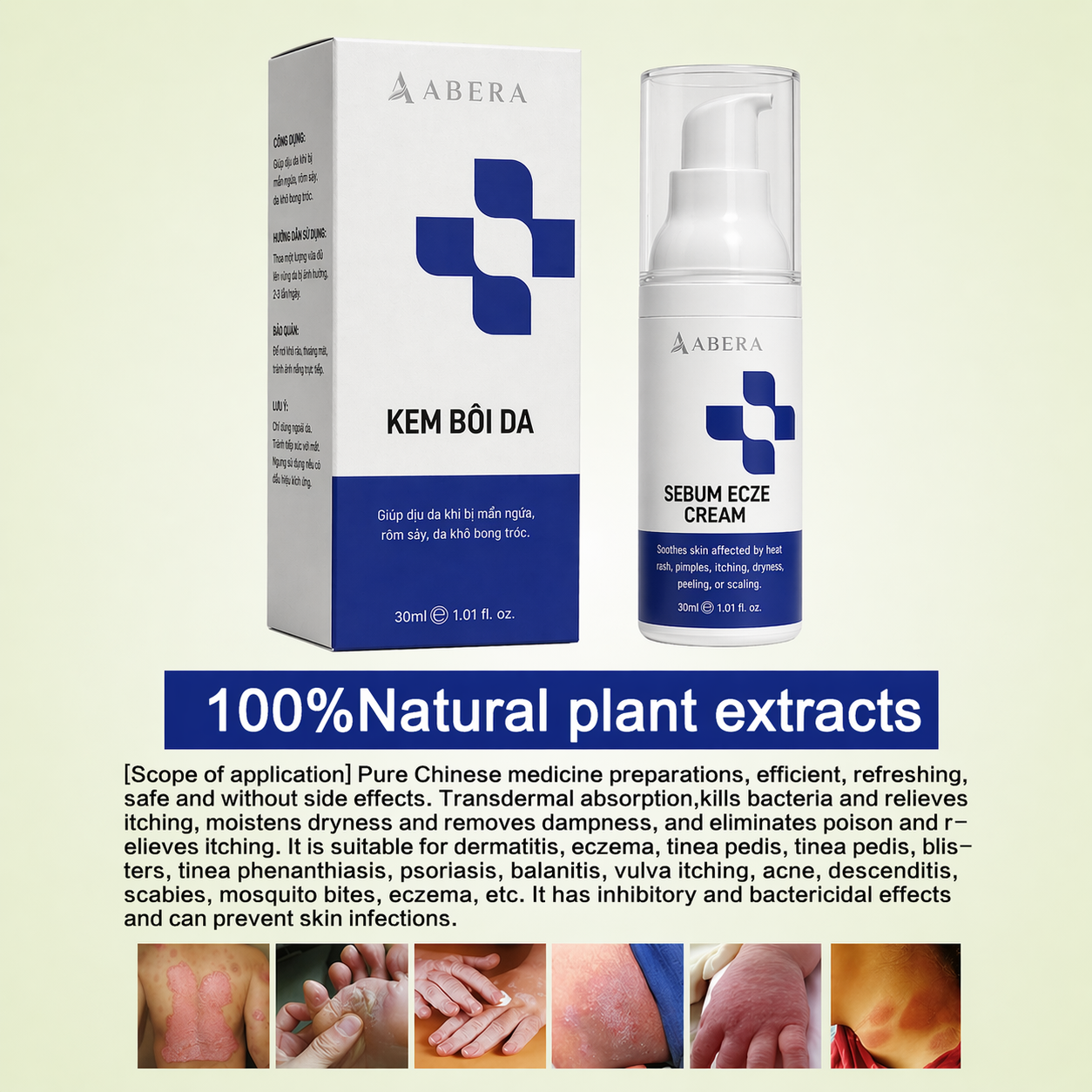 Abera Sebum Ecze Crema - Loción corporal completa para pieles con tendencia a la psoriasis, crema hidratante para eccemas, hidratante corporal, tubo de 1 oz. - Auténtico