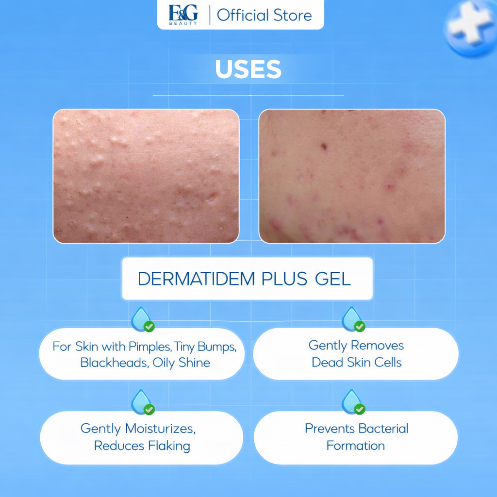 Dermatidem Plus Gel - 0.67oz (20g) - Authentic - US