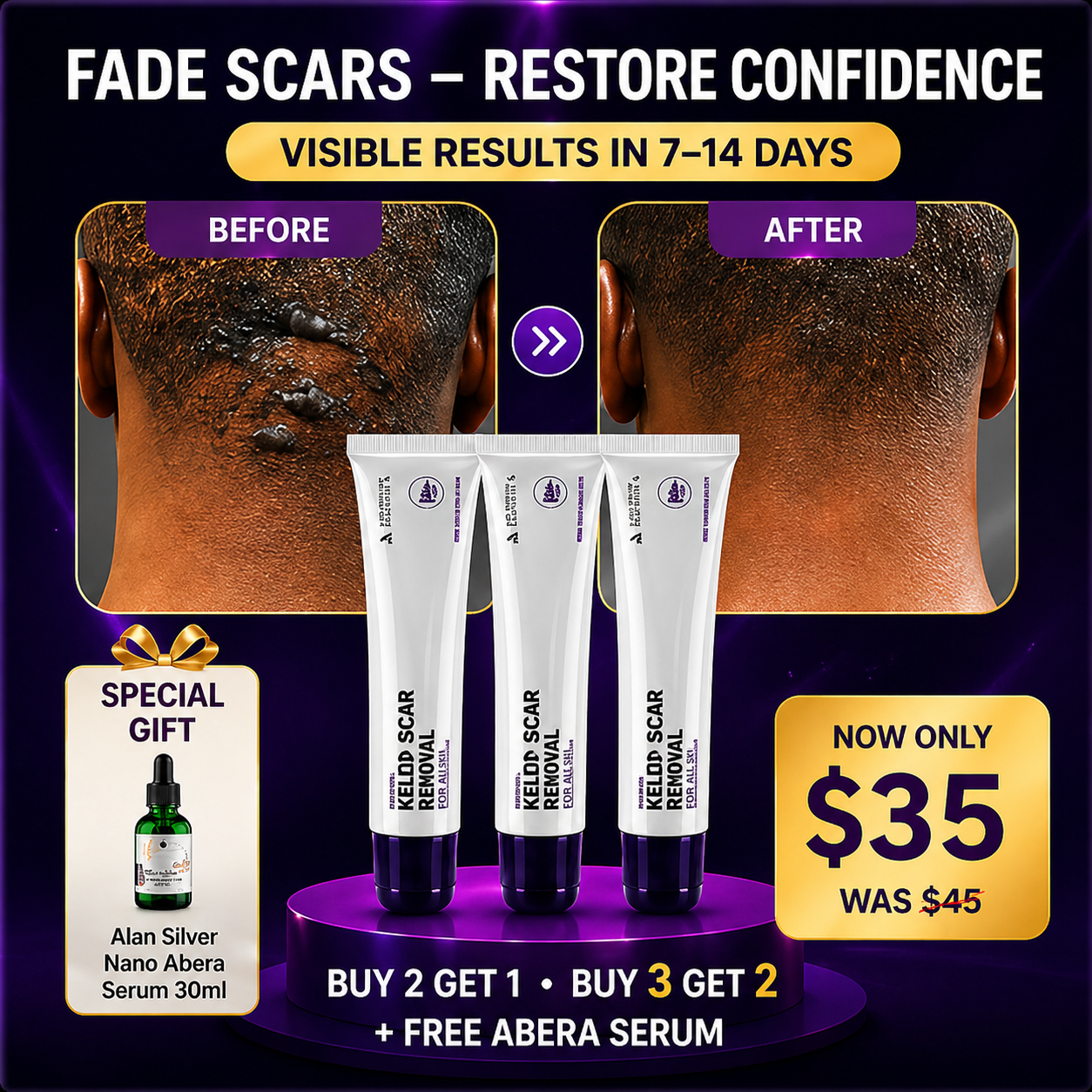 Abera Kelo Scar Cream – Fórmula clínica para cicatrices elevadas