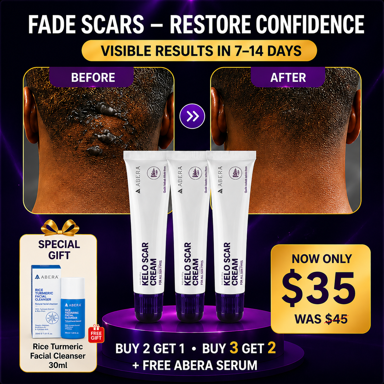 Abera Kelo Scar Cream – Clinical Formula for Raised Scars