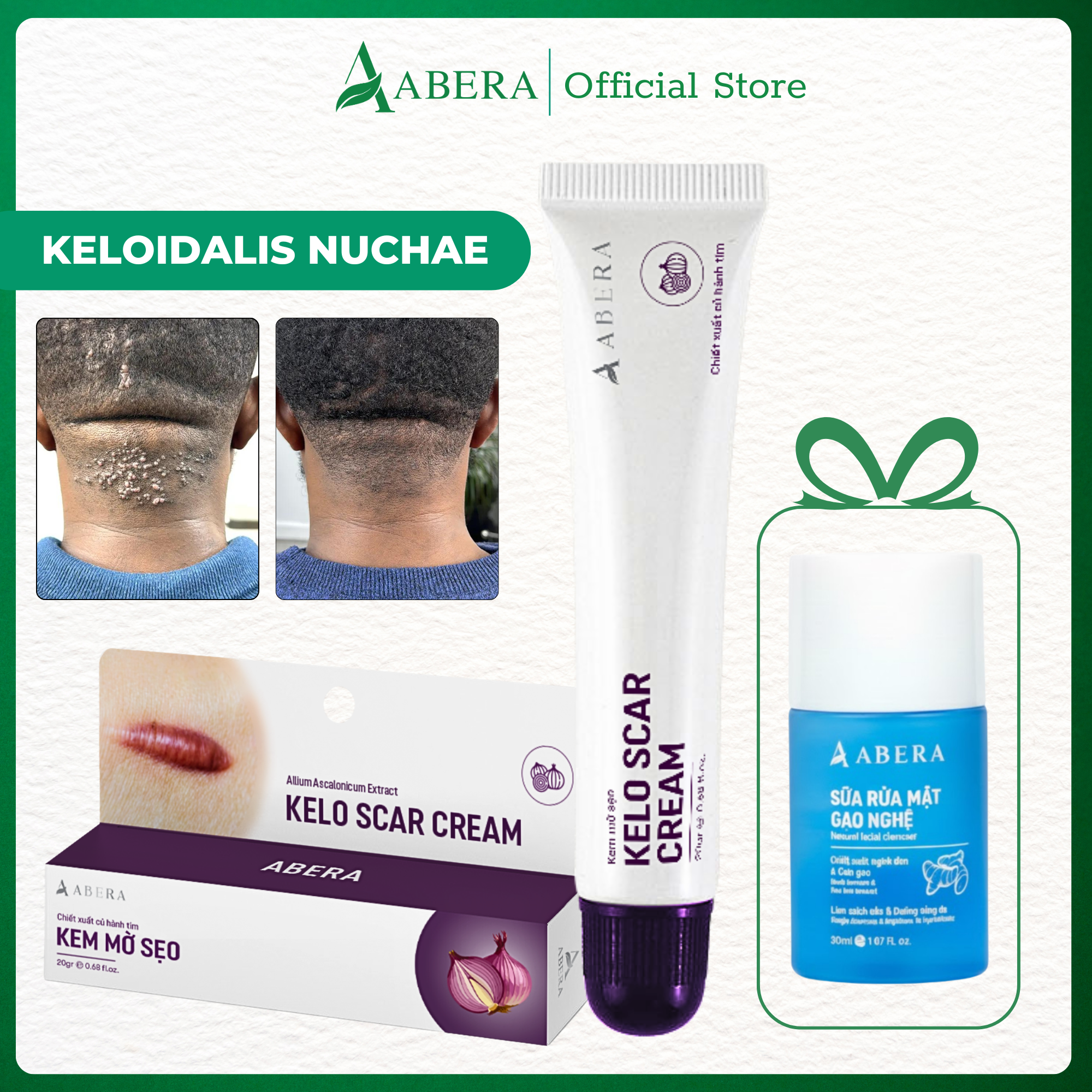 Abera Kelo Crema para Cicatrices - Tienda Oficial