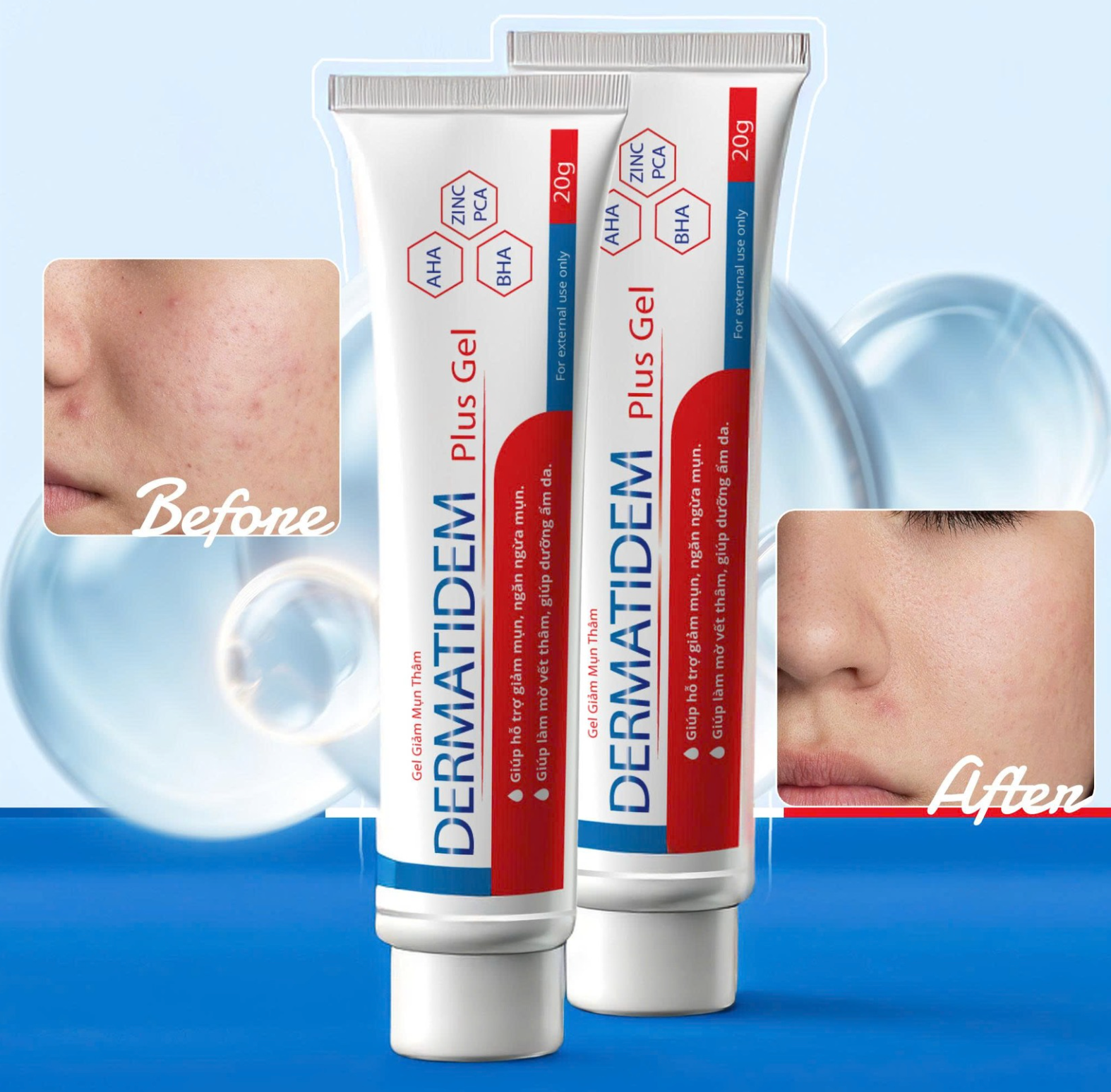 Dermatidem Plus Gel - 0.67oz (20g) - Authentic - US