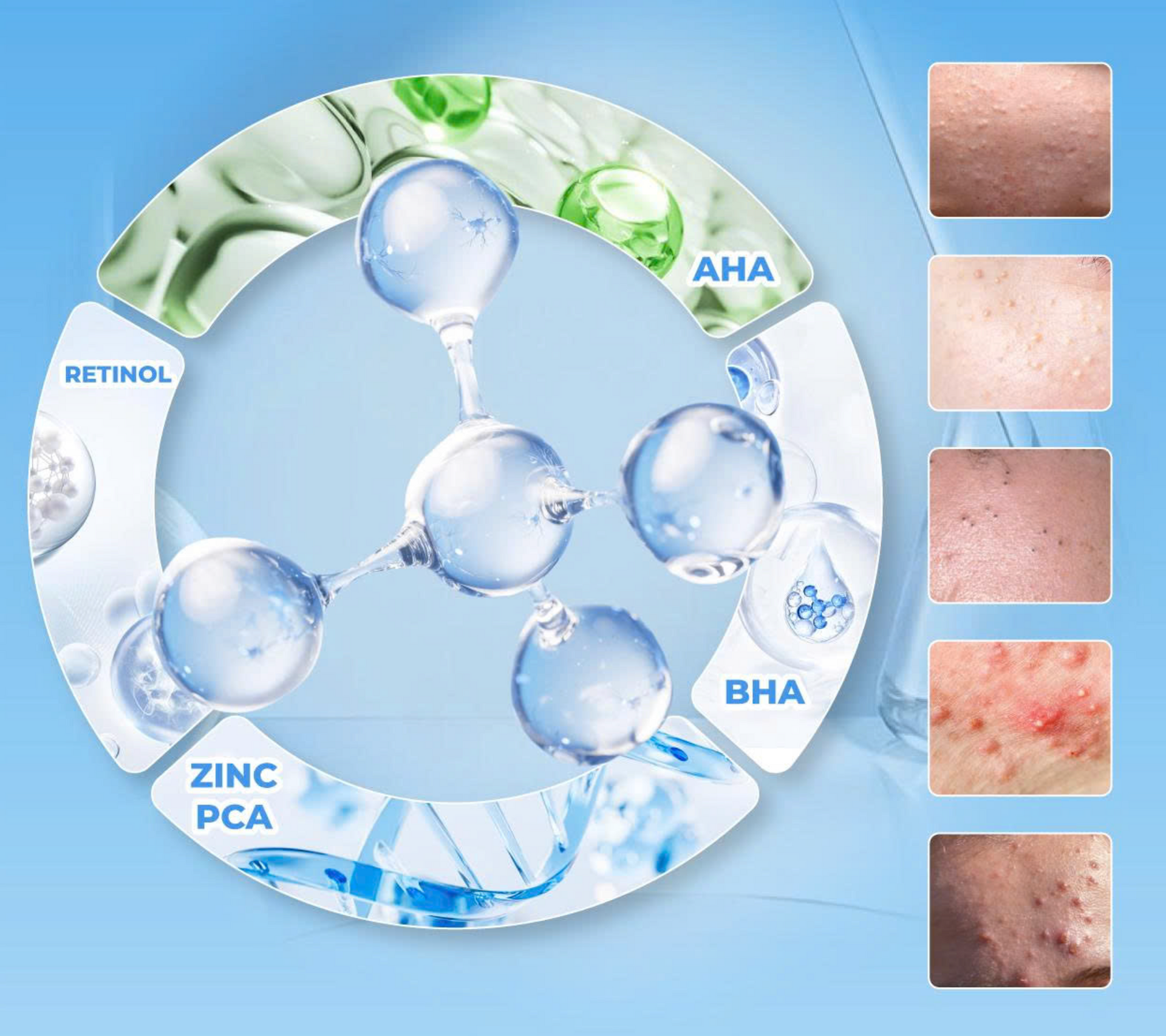 Dermatidem Plus Gel - 0.67oz (20g) - Authentic - US