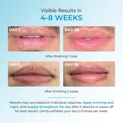 Fordyce Cream for Lips