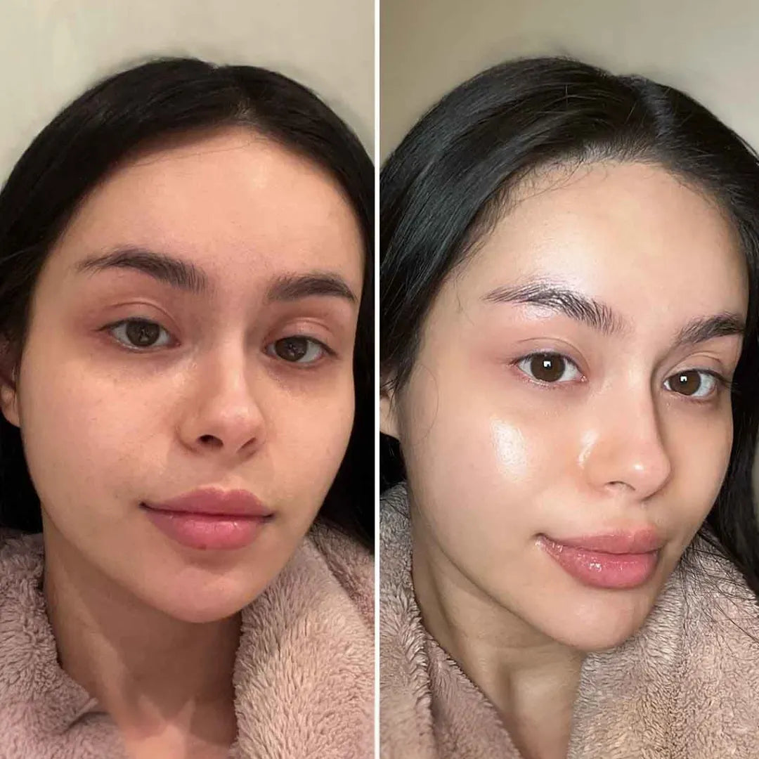 Dark Spot Correcting Duo – Targets Localized Dark Spots for an Even, Radiant Complexion