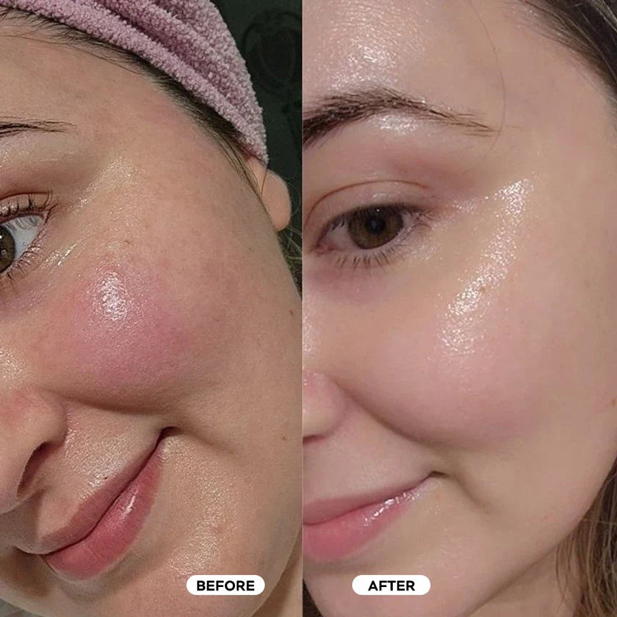 Kasumi Abera Cream - Best Seller - US