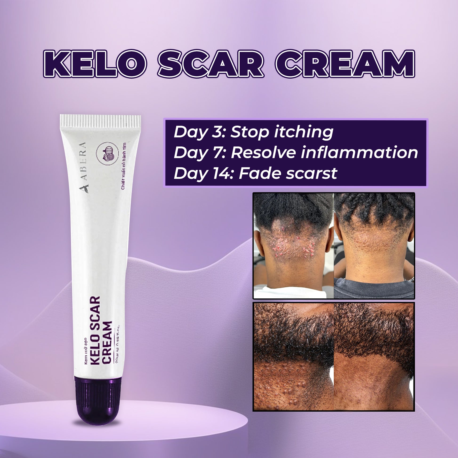Abera Kelo Crema Cicatrizante - Más Vendido
